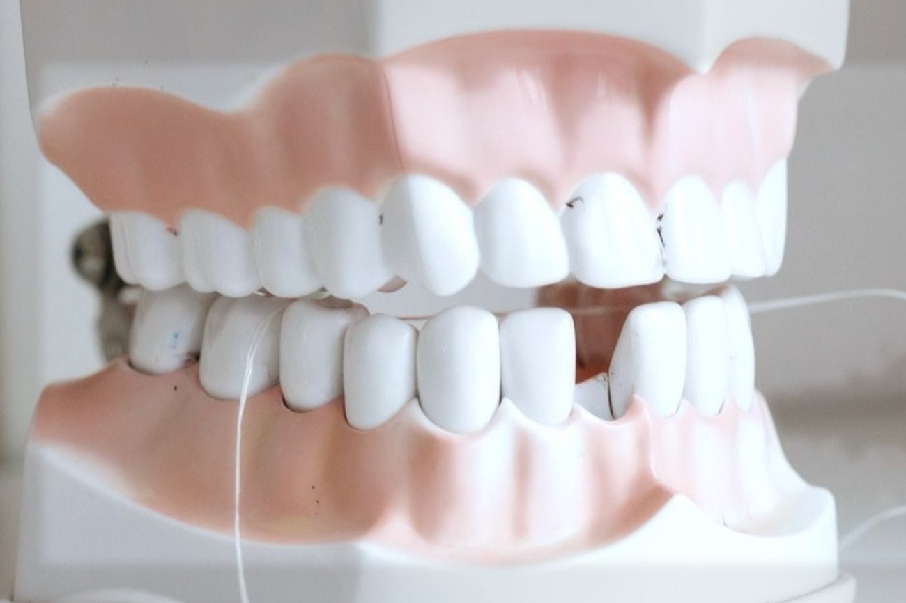 A clean dental model of healthy teeth and gums with a bright, whitened shade (illustrative of a professional-whitening result)